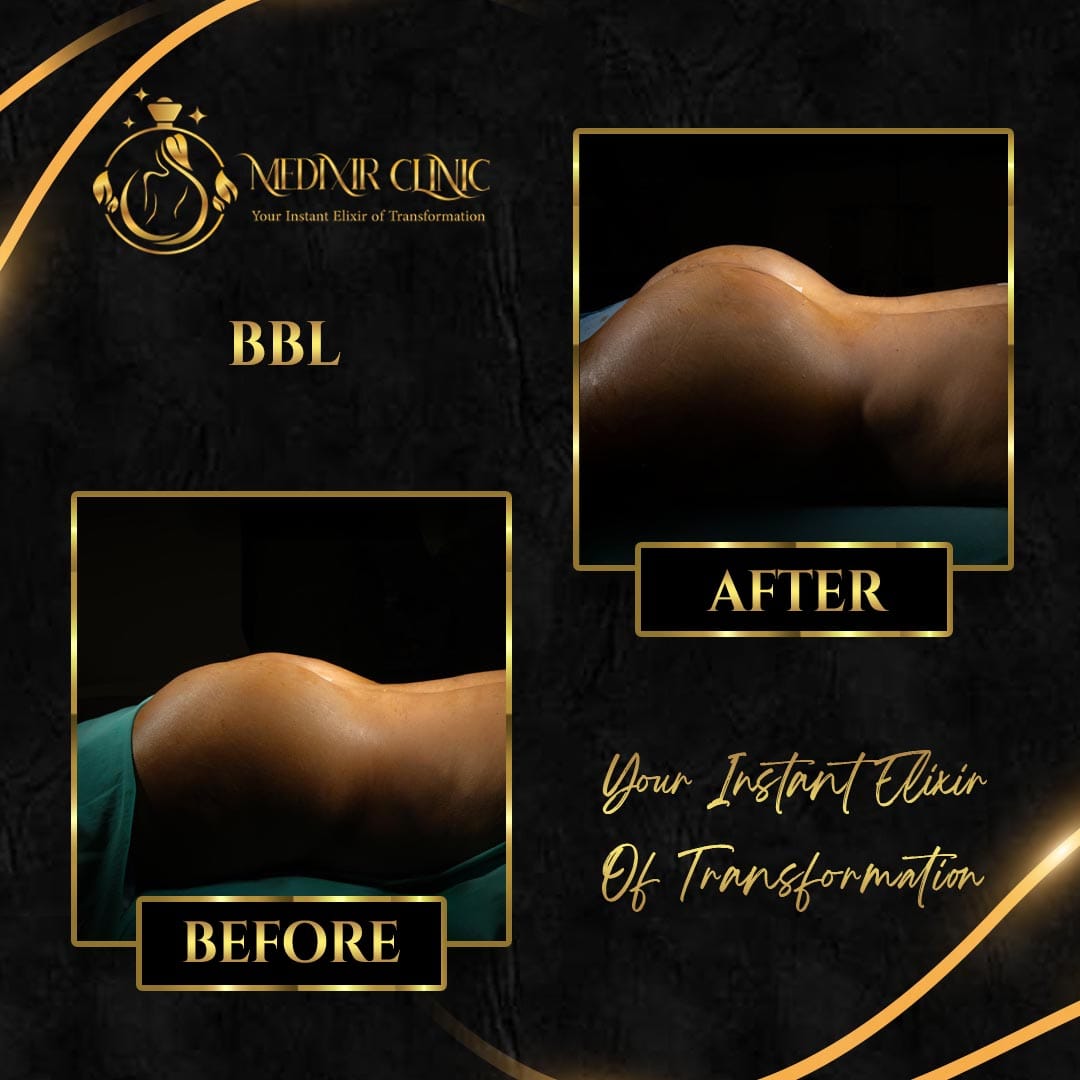 Medixir Clinic — Before & After 1