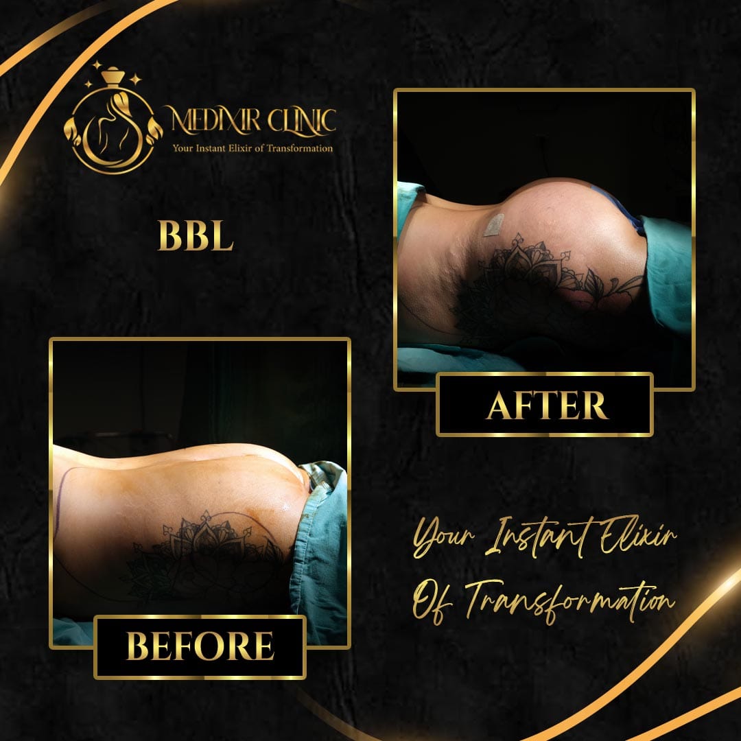 Medixir Clinic — Before & After 2