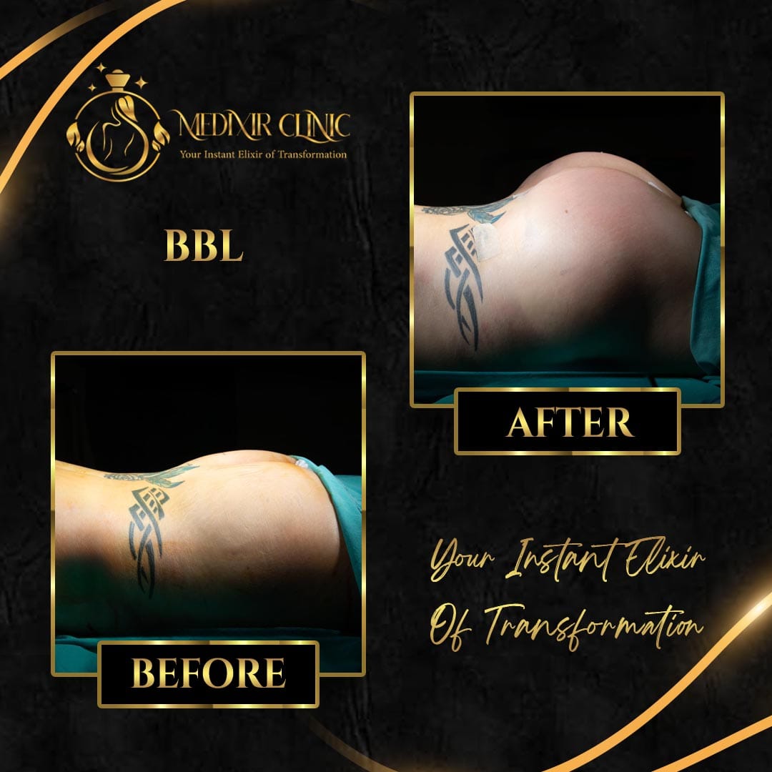 Medixir Clinic — Before & After 3