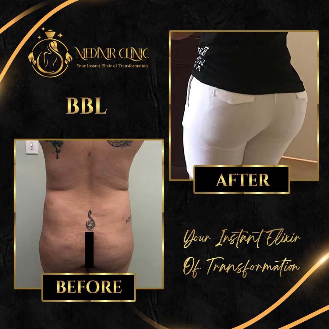 Medixir Clinic — Before & After 4