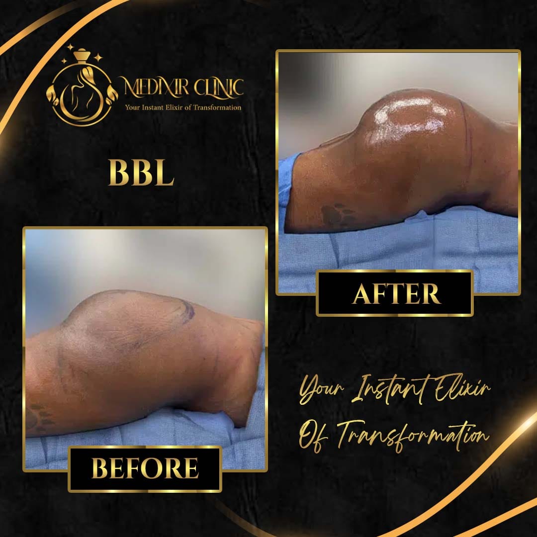 Medixir Clinic — Before & After 5