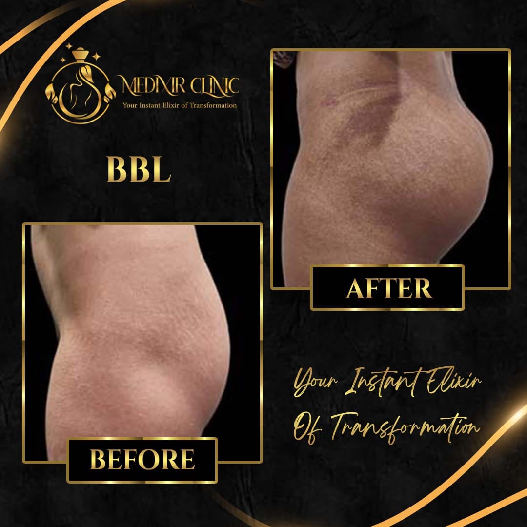 Medixir Clinic — Before & After 6