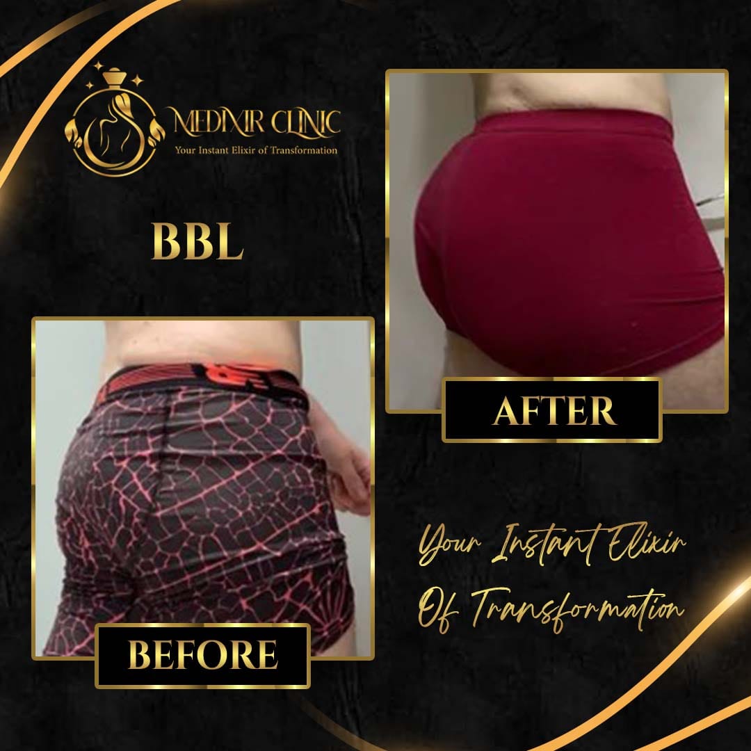 Medixir Clinic — Before & After 7