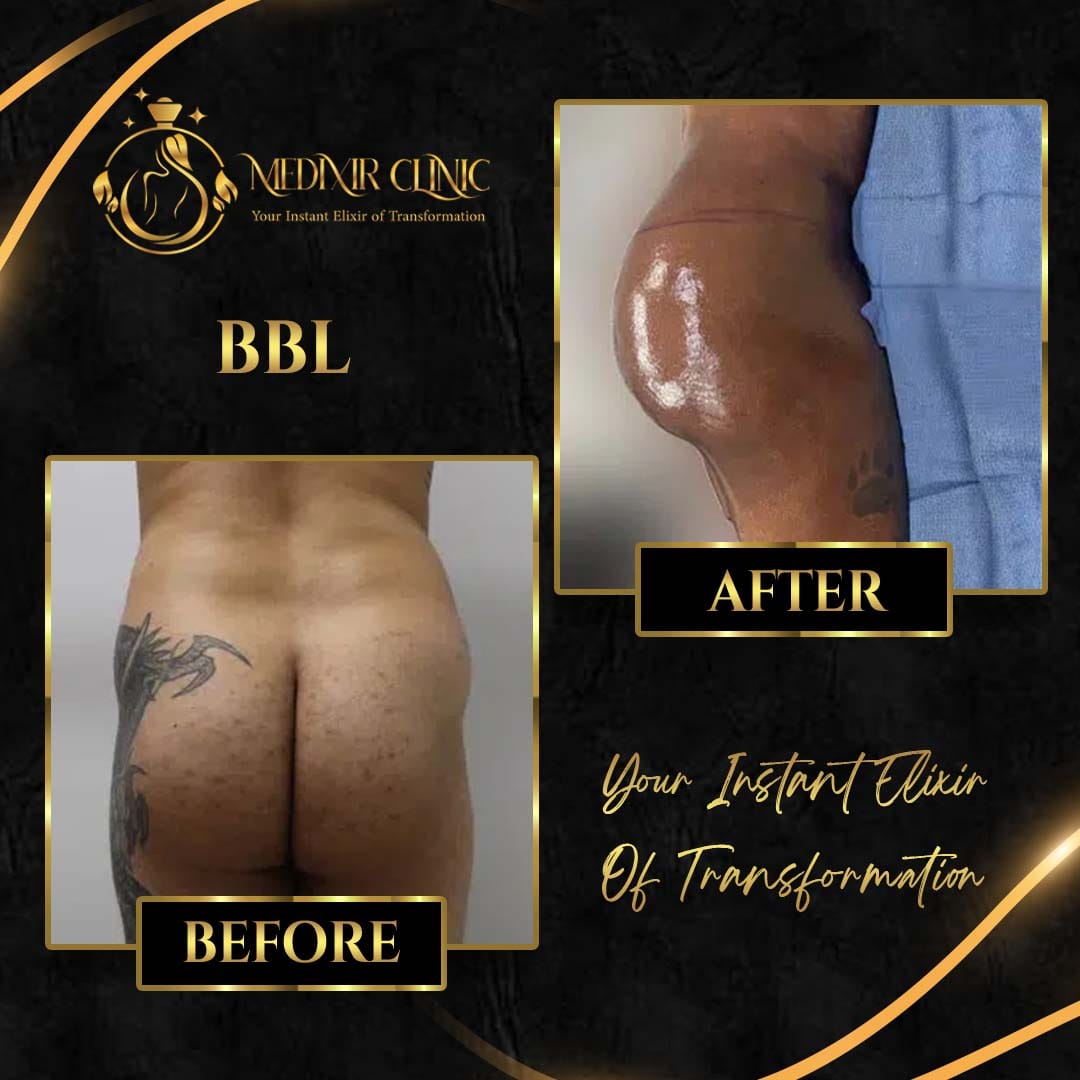 Medixir Clinic — Before & After 8