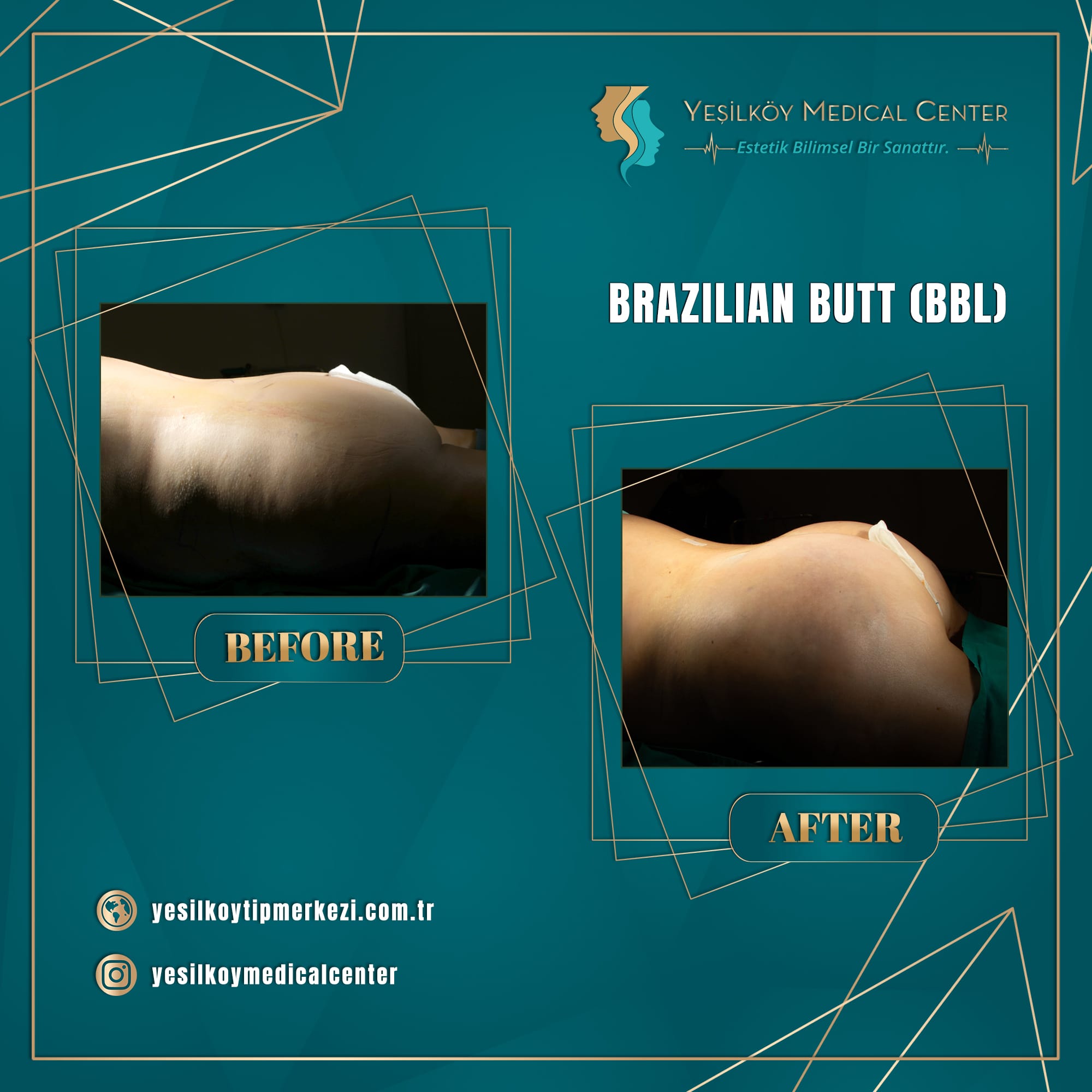 Yesilkoy Medical Center — Before & After 1