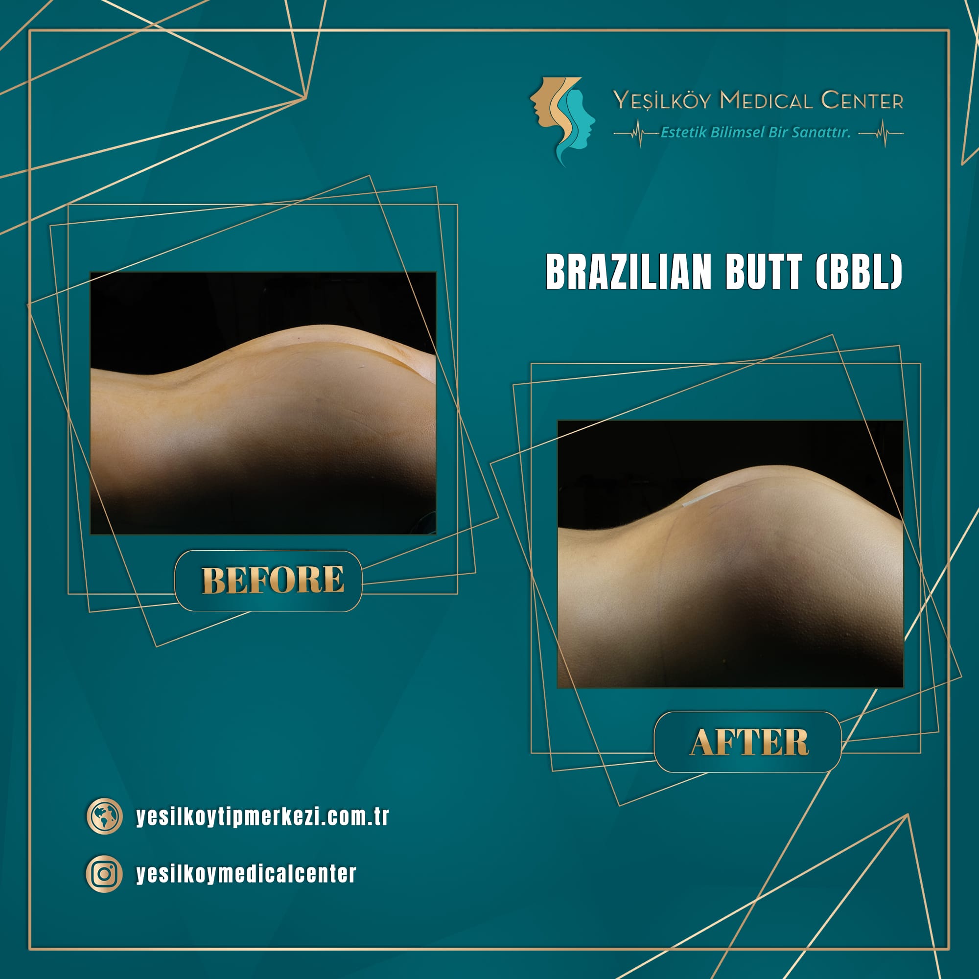 Yesilkoy Medical Center — Before & After 2