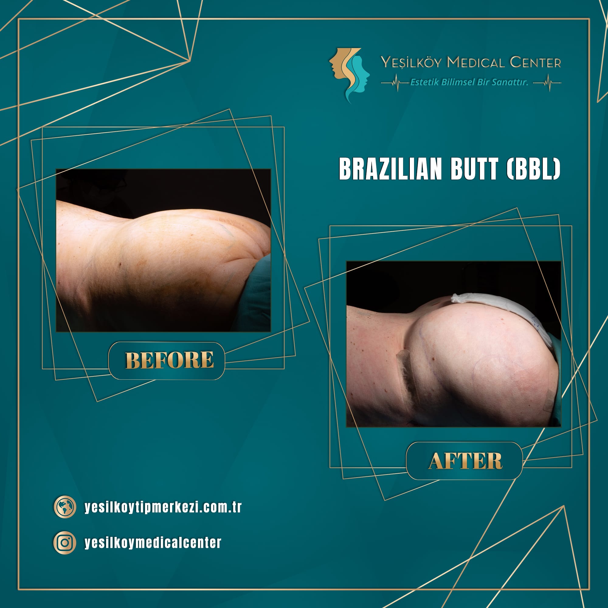 Yesilkoy Medical Center — Before & After 3