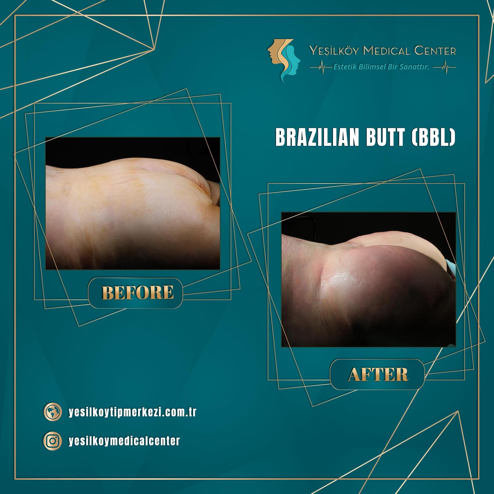 Yesilkoy Medical Center — Before & After 4