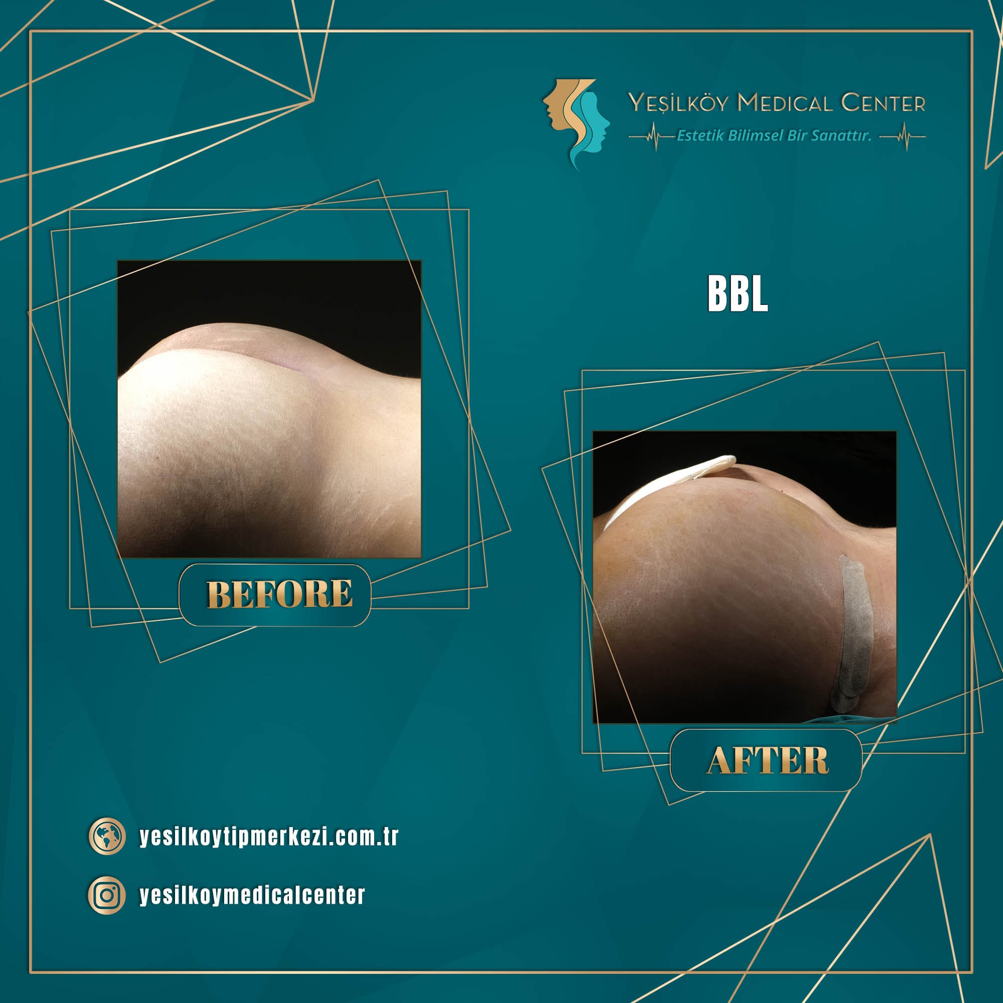 Yesilkoy Medical Center — Before & After 5