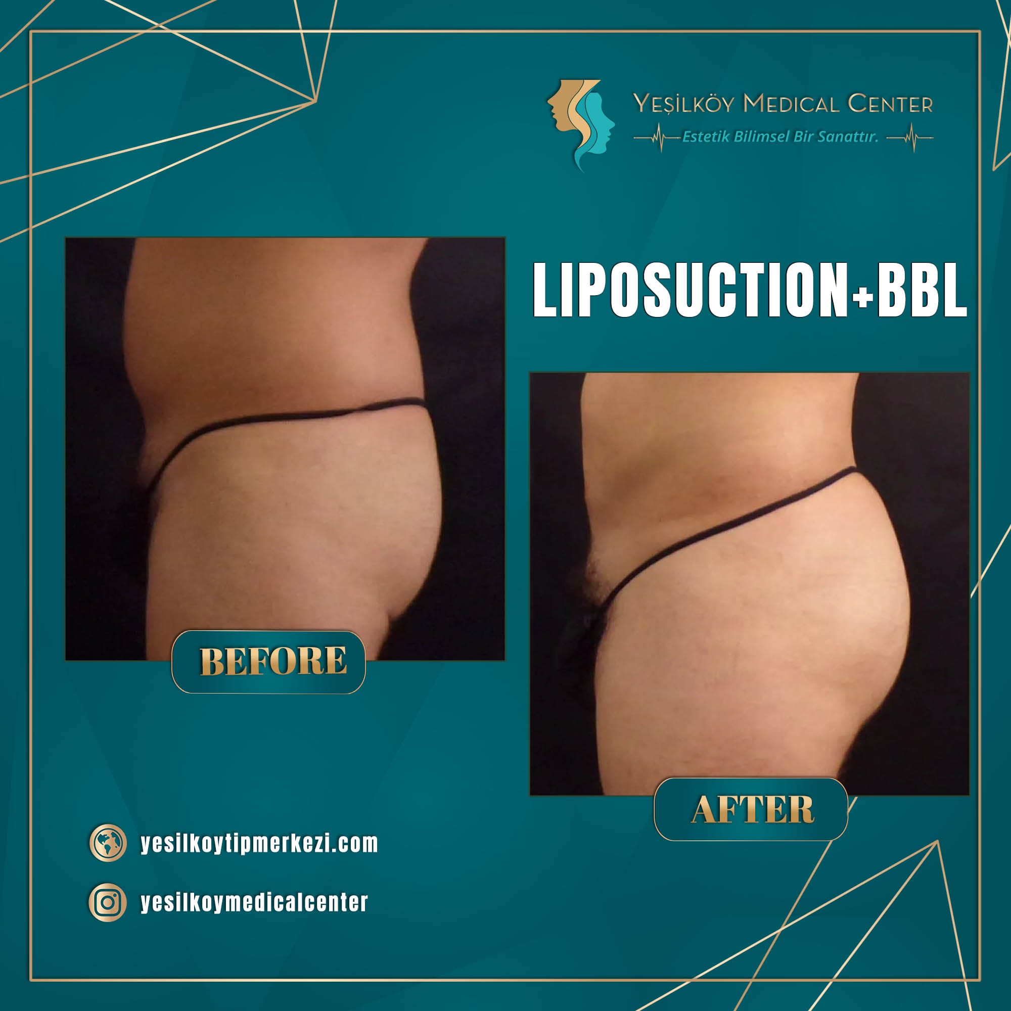 Yesilkoy Medical Center — Before & After 6