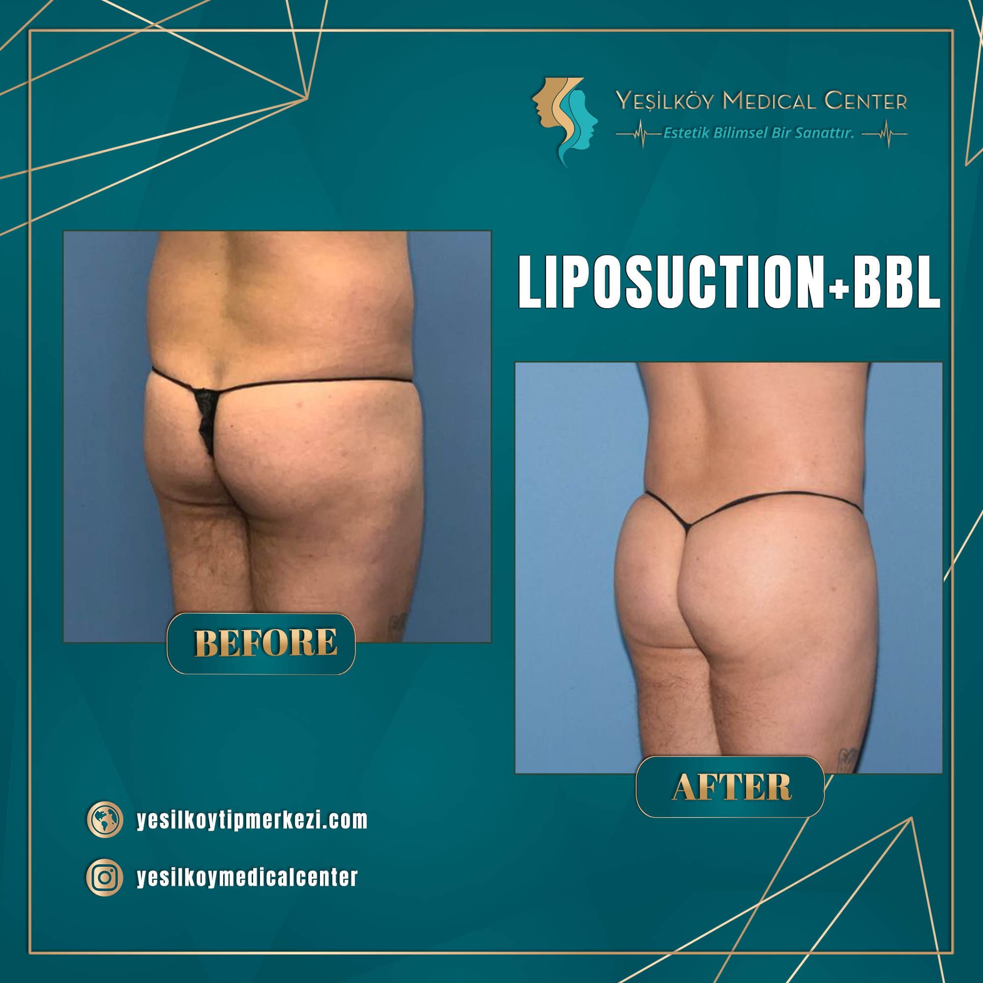 Yesilkoy Medical Center — Before & After 7