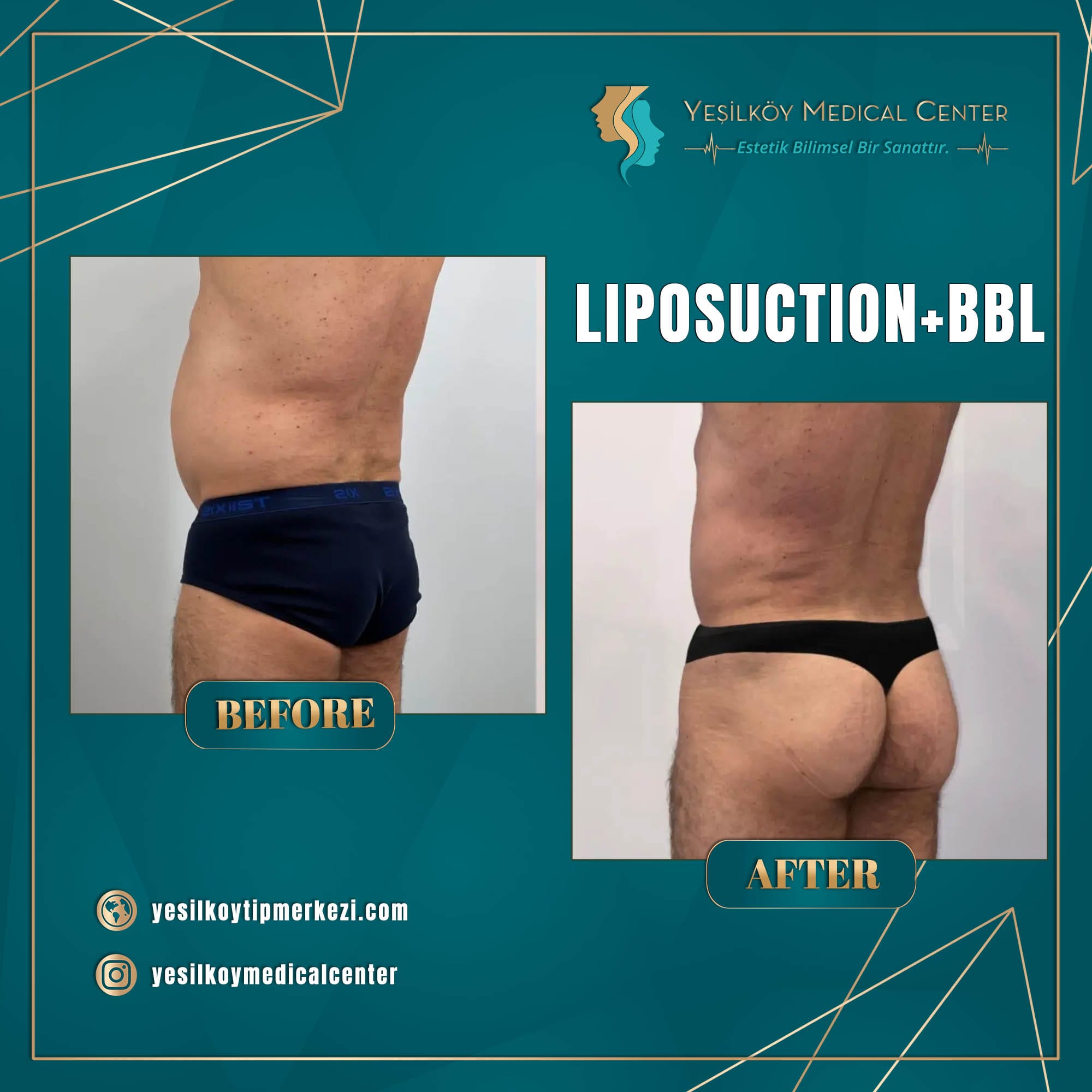 Yesilkoy Medical Center — Before & After 8