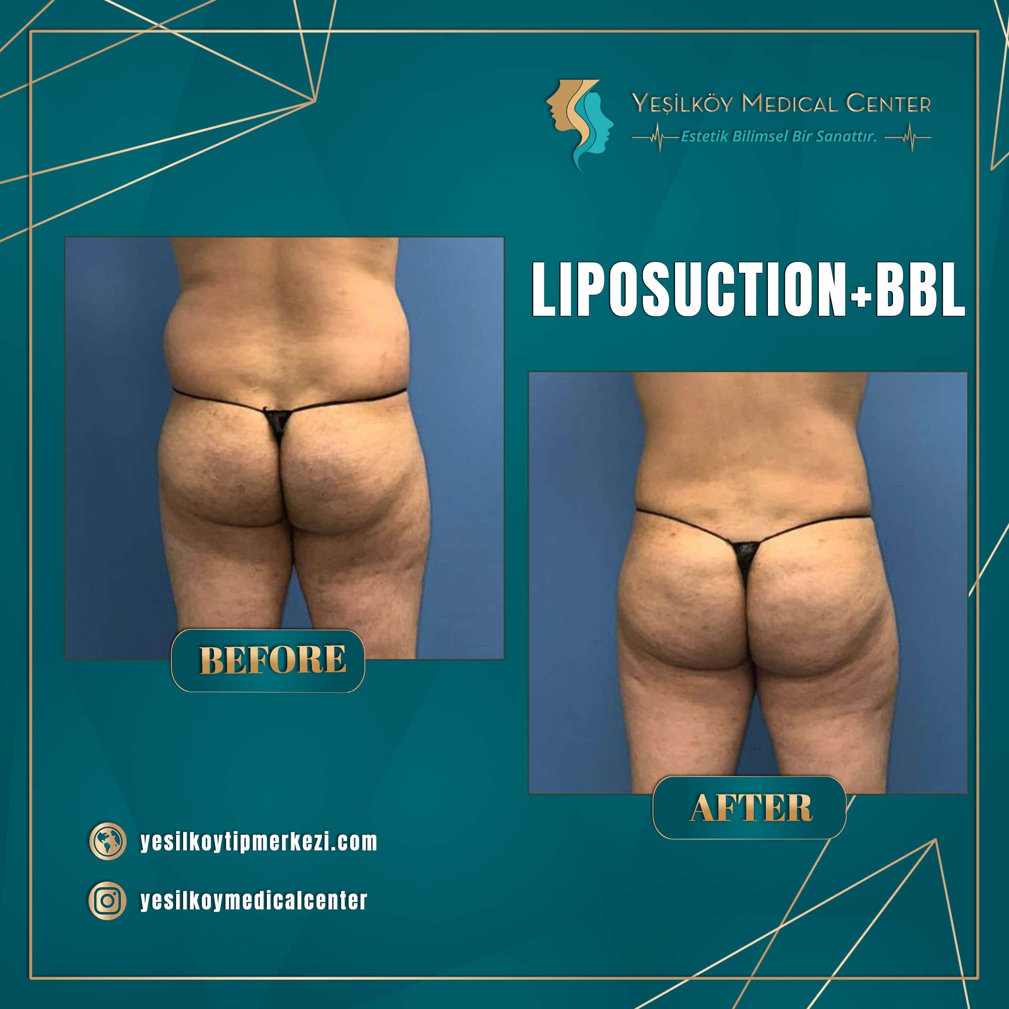 Yesilkoy Medical Center — Before & After 9