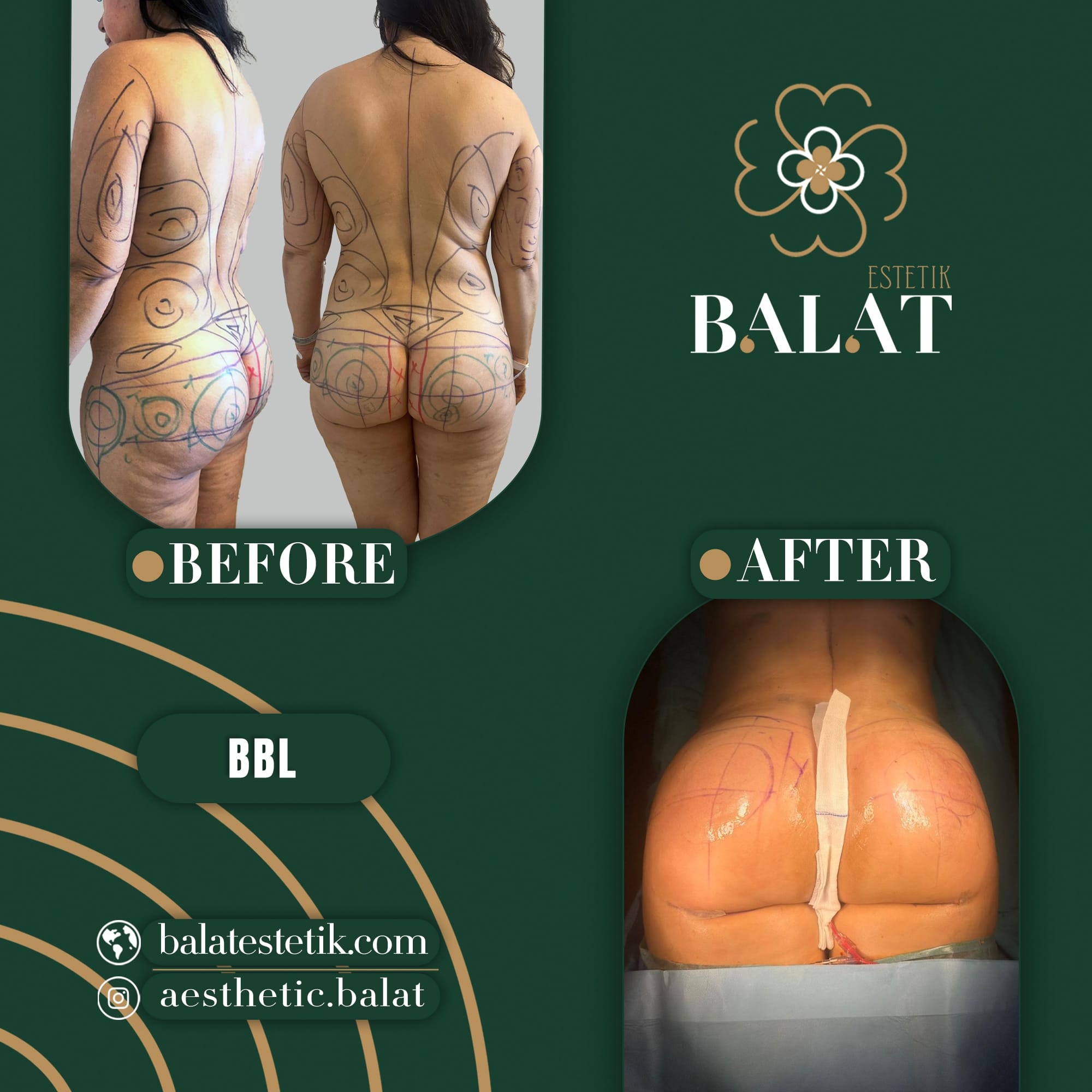 Balat Aesthetic — Before & After 5