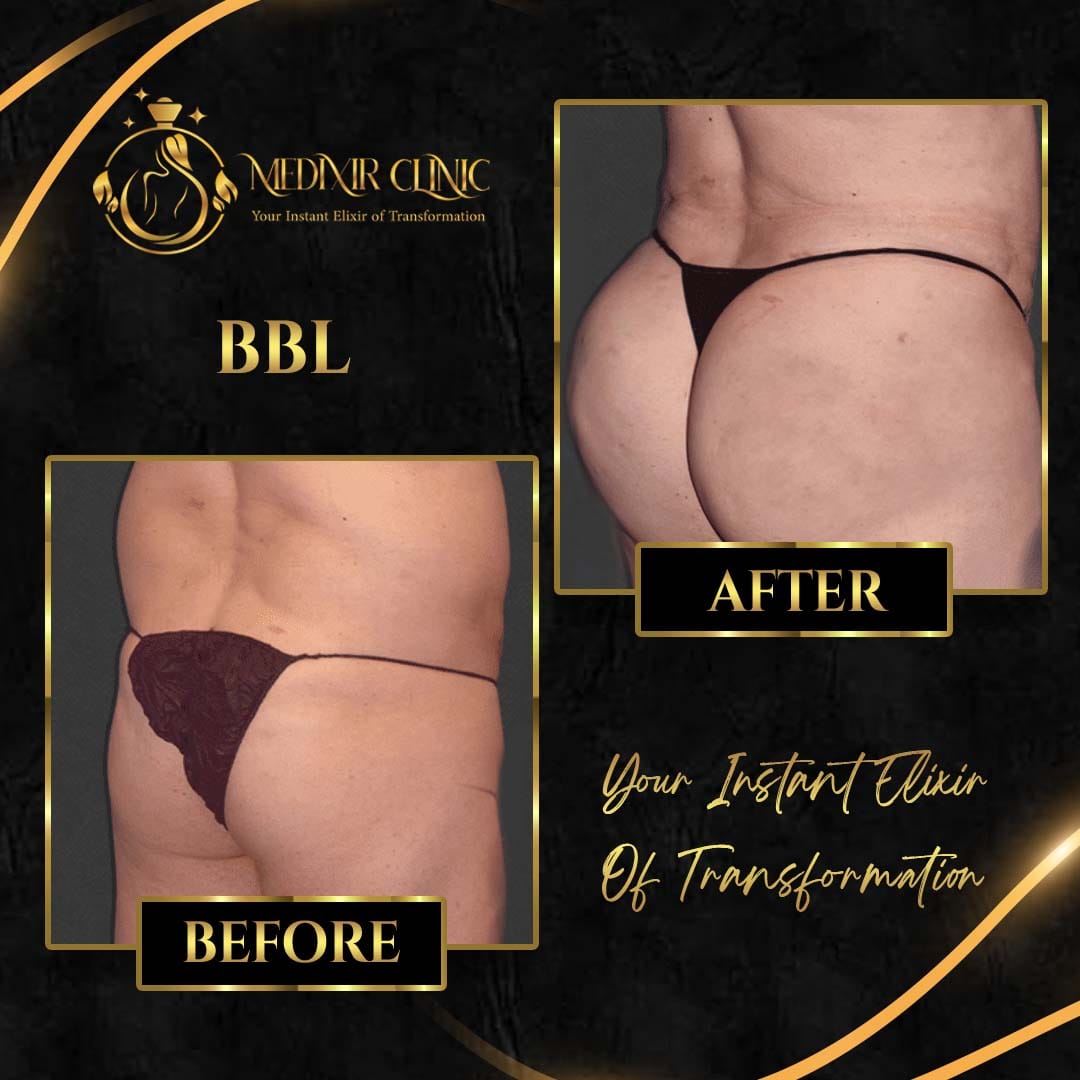 Medixir Clinic — Before & After 9